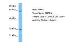 SNRPN Rabbit anti-Human, Polyclonal, Novus Biologicals 0.1ml; Unconjugated:Antibodies,